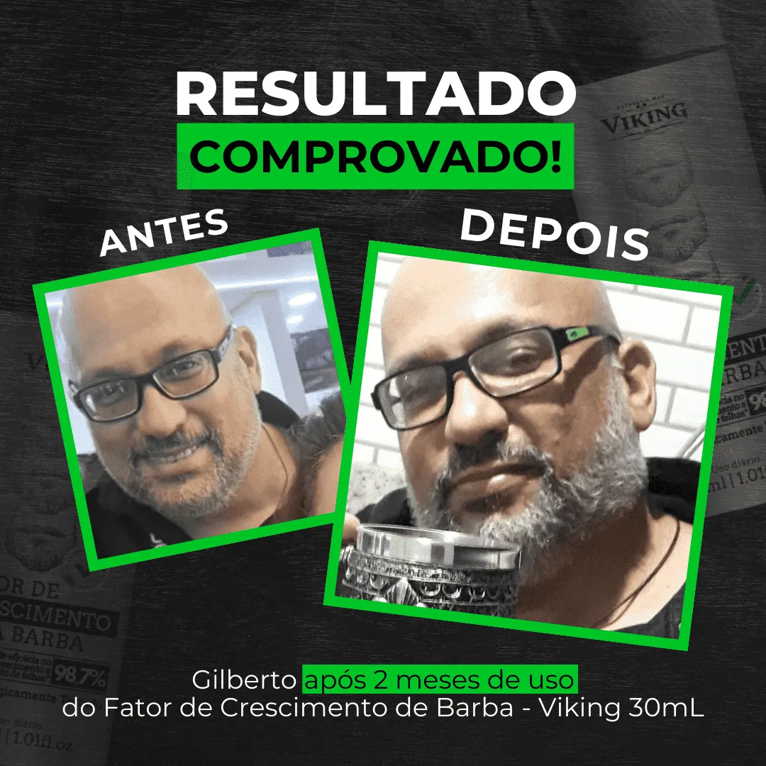 Fator de Crescimento para Barba - Viking Brand - 30 mL