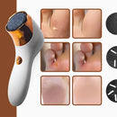 Removedor de Calos Elétrico para Pés - BRANCO